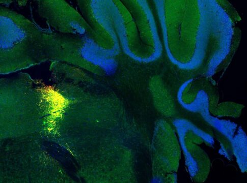 Decoding-waves-of-brain-activity-